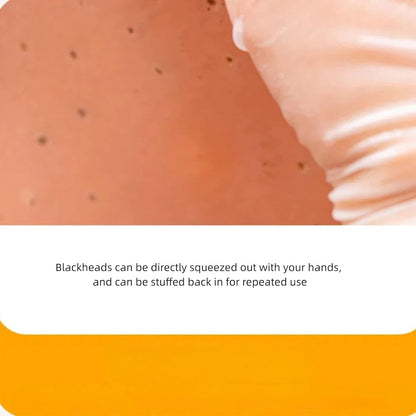 Refillable Pimple Popping Toy, Realistic Blackhead Extraction Simulator, Facial Pimplee Cleansing Toys, Stress & Anxiety Relief, Funny Gag Gift