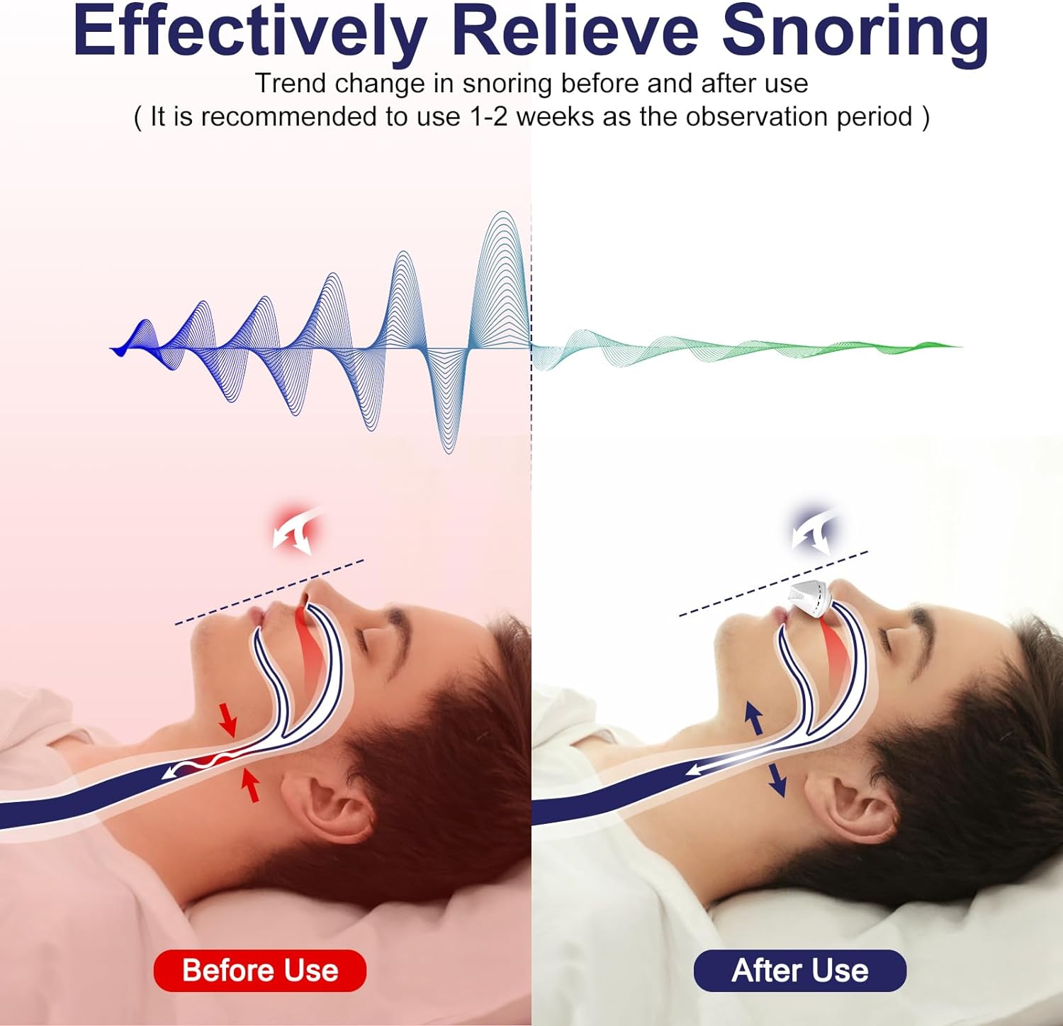 Anti Snoring Device, Adjustable Wind Speed Snoring Solution, Stop Snoring Suitable for Men and Women - Cykapu